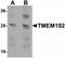 Transmembrane Protein 192 antibody, TA320141, Origene, Western Blot image 