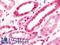 DEAF1 Transcription Factor antibody, LS-B10862, Lifespan Biosciences, Immunohistochemistry paraffin image 