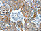 Aldehyde Dehydrogenase 6 Family Member A1 antibody, CSB-PA280938, Cusabio, Immunohistochemistry paraffin image 