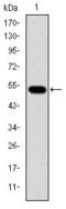 Glucokinase antibody, GTX60474, GeneTex, Western Blot image 