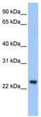 Tripartite Motif Containing 48 antibody, TA339244, Origene, Western Blot image 