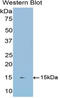 Cadherin 1 antibody, LS-C301378, Lifespan Biosciences, Western Blot image 