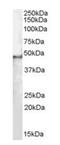 Splicing Factor 3b Subunit 4 antibody, orb18682, Biorbyt, Western Blot image 