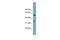 Threonine Synthase Like 2 antibody, GTX44955, GeneTex, Western Blot image 