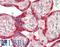 Vesicle Associated Membrane Protein 7 antibody, LS-B11937, Lifespan Biosciences, Immunohistochemistry paraffin image 