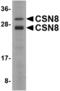 COP9 Signalosome Subunit 8 antibody, LS-B4592, Lifespan Biosciences, Western Blot image 