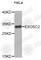 Exosome Component 2 antibody, A4549, ABclonal Technology, Western Blot image 