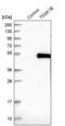 Testis Specific Serine Kinase 1B antibody, PA5-55706, Invitrogen Antibodies, Western Blot image 