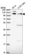 Pleckstrin Homology Domain Containing A5 antibody, NBP2-58961, Novus Biologicals, Western Blot image 