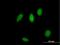 Zinc Finger Protein 83 antibody, H00055769-B01P, Novus Biologicals, Immunofluorescence image 
