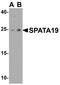 Spermatogenesis Associated 19 antibody, PA5-72740, Invitrogen Antibodies, Western Blot image 