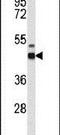 Gamma-Aminobutyric Acid Type A Receptor Delta Subunit antibody, PA5-26307, Invitrogen Antibodies, Western Blot image 