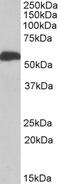 Aldehyde Dehydrogenase 5 Family Member A1 antibody, STJ72394, St John