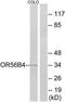 Olfactory Receptor Family 56 Subfamily B Member 4 antibody, TA316210, Origene, Western Blot image 