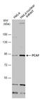 Lysine Acetyltransferase 2B antibody, GTX12188, GeneTex, Western Blot image 