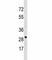 Voltage Dependent Anion Channel 3 antibody, F45322-0.4ML, NSJ Bioreagents, Western Blot image 