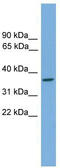 General Transcription Factor IIH Subunit 3 antibody, TA329633, Origene, Western Blot image 