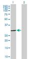 Stomatin antibody, H00002040-D01P, Novus Biologicals, Western Blot image 