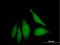 WD Repeat, Sterile Alpha Motif And U-Box Domain Containing 1 antibody, H00151525-B01P, Novus Biologicals, Immunofluorescence image 