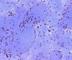 Bone Marrow Stromal Cell Antigen 2 antibody, DDX0390P-100, Novus Biologicals, Western Blot image 
