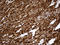 Interferon Induced Transmembrane Protein 2 antibody, LS-C792863, Lifespan Biosciences, Immunohistochemistry paraffin image 