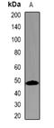 Transmembrane protease serine 2 antibody, LS-B14581, Lifespan Biosciences, Western Blot image 