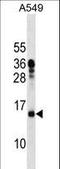 Mitochondrial Ribosomal Protein L11 antibody, LS-C158297, Lifespan Biosciences, Western Blot image 