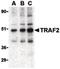 TNF receptor-associated factor 2 antibody, PA5-20192, Invitrogen Antibodies, Western Blot image 