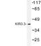 Potassium Voltage-Gated Channel Subfamily J Member 9 antibody, LS-C177376, Lifespan Biosciences, Western Blot image 