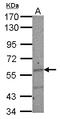 IKAROS Family Zinc Finger 2 antibody, LS-C155432, Lifespan Biosciences, Western Blot image 