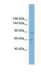 TBC1 Domain Containing Kinase antibody, NBP1-56343, Novus Biologicals, Western Blot image 