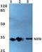 Nucleolar Protein Interacting With The FHA Domain Of MKI67 antibody, A04797, Boster Biological Technology, Western Blot image 