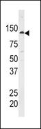 Hexokinase 1 antibody, PA5-15448, Invitrogen Antibodies, Western Blot image 