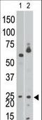 BCL2 Interacting Protein 3 antibody, LS-C98865, Lifespan Biosciences, Western Blot image 