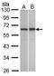 TNFAIP3 Interacting Protein 2 antibody, PA5-28918, Invitrogen Antibodies, Western Blot image 