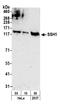 Slingshot Protein Phosphatase 1 antibody, A301-309A, Bethyl Labs, Western Blot image 