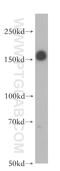 Insulin Receptor Substrate 1 antibody, 17509-1-AP, Proteintech Group, Western Blot image 