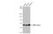 Protein Kinase AMP-Activated Catalytic Subunit Alpha 1 antibody, GTX112999, GeneTex, Western Blot image 