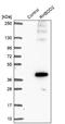 Rhomboid Domain Containing 2 antibody, NBP2-47305, Novus Biologicals, Western Blot image 