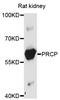 Lysosomal Pro-X carboxypeptidase antibody, STJ25100, St John
