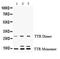 Transthyretin antibody, PA5-80197, Invitrogen Antibodies, Western Blot image 