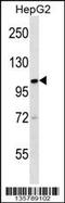 Kinesin Family Member 18A antibody, 58-460, ProSci, Western Blot image 