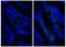 Integrin Subunit Beta 4 antibody, 99-002, ProSci, Immunohistochemistry paraffin image 