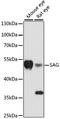 Ring Finger Protein 7 antibody, A13045, ABclonal Technology, Western Blot image 