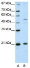 Zinc Finger And SCAN Domain Containing 20 antibody, TA345521, Origene, Western Blot image 