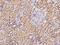 TYRO3 Protein Tyrosine Kinase antibody, 203468-T08, Sino Biological, Immunohistochemistry paraffin image 