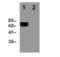 Perforin 1 antibody, NBP1-97512, Novus Biologicals, Western Blot image 