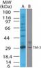 Hepatitis A Virus Cellular Receptor 2 antibody, NB100-56422, Novus Biologicals, Western Blot image 