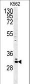 Chromosome 2 Open Reading Frame 49 antibody, LS-C168096, Lifespan Biosciences, Western Blot image 