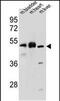 BTB Domain Containing 17 antibody, PA5-48250, Invitrogen Antibodies, Western Blot image 